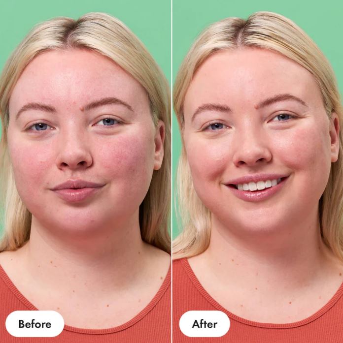 Rescue Balm Red Correct