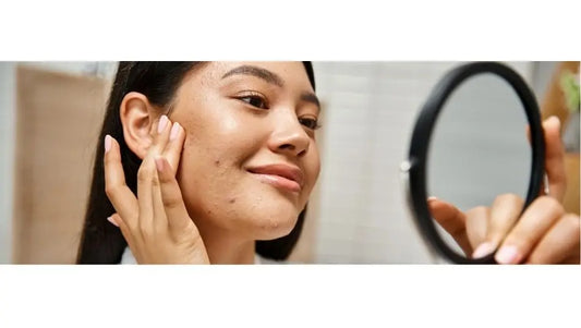 How many different types of acne are there?