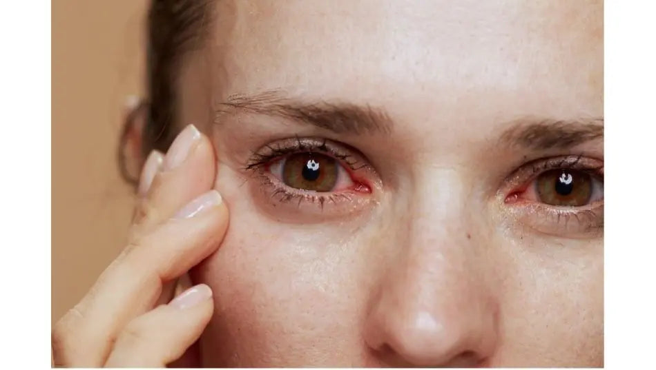 How allergies can affect your skin