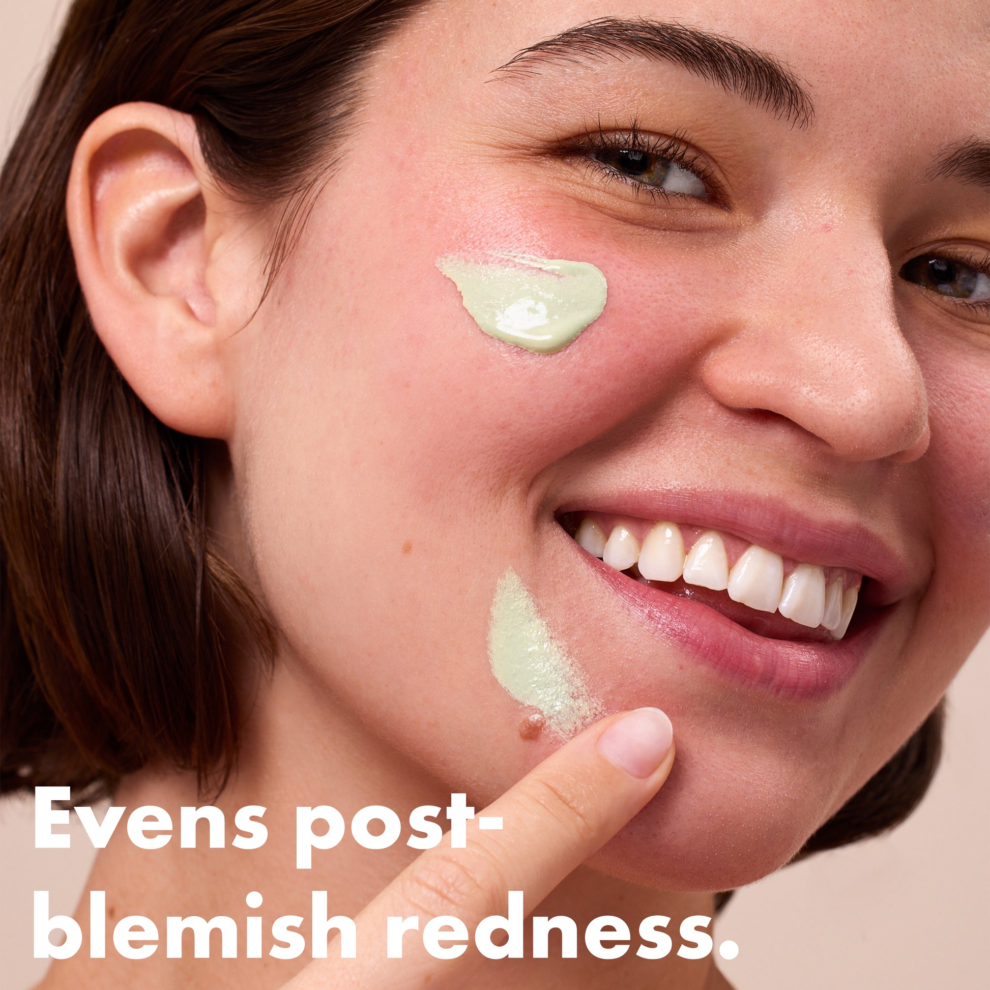 Rescue Balm Red Correct