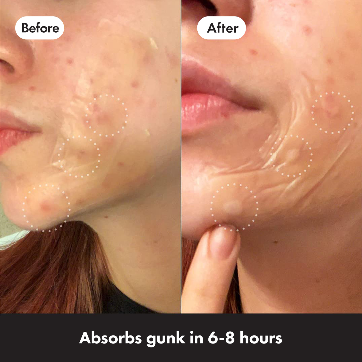 MIGHTY PATCH ™ Surface