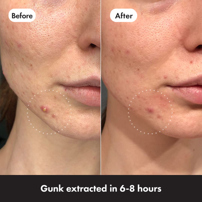 MIGHTY PATCH Invisible