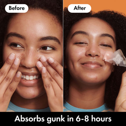 MIGHTY PATCH ™ Nose