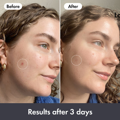 Rescue Balm Original