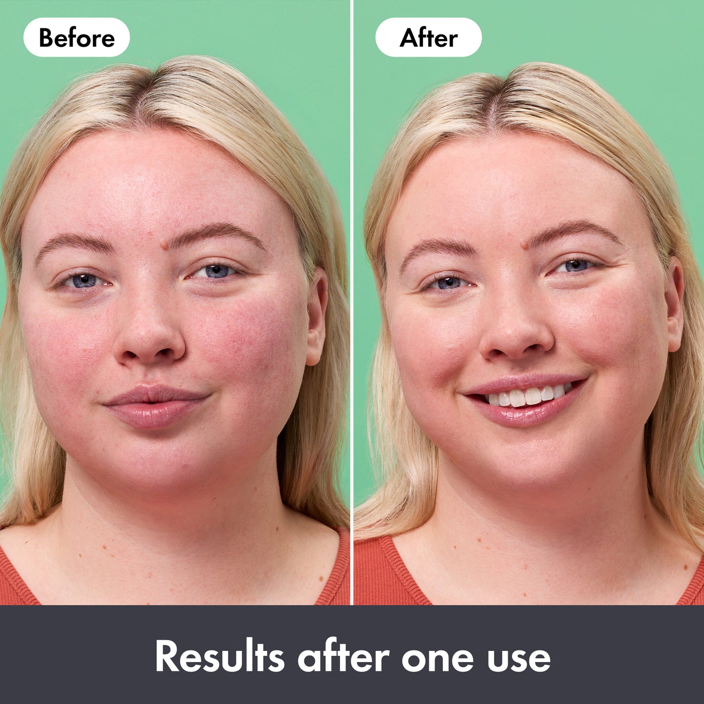 Rescue Balm Red Correct