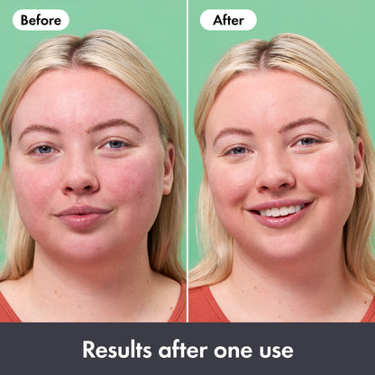 Rescue Balm Red Correct